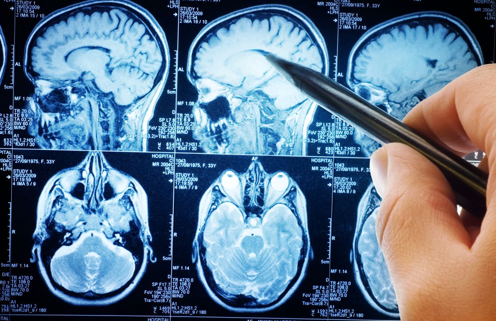 Magnetic,Resonance,Image,(mri),Of,The,Brain